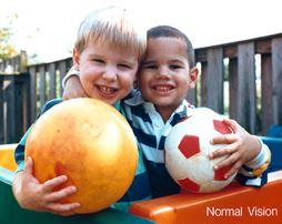 Normal Vision