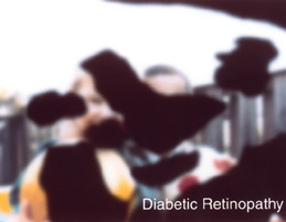 Diabetic